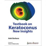 Funded account trading brokers vs proprietary trading firm— key fferences